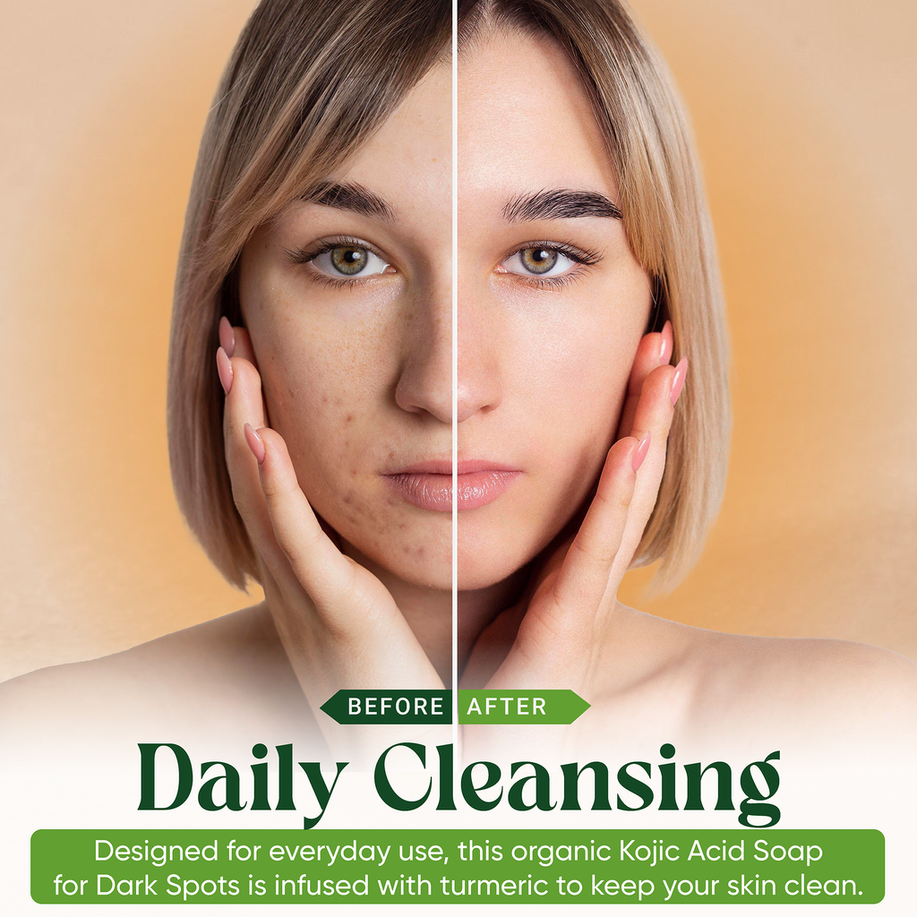 AMVital Turmeric Kojic Acid Soap Bar — Dark Spot & Mark Fading Soap
